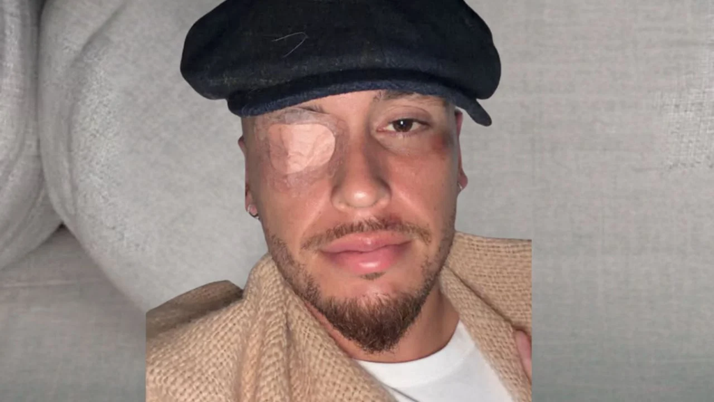 Parálisis Facial Aleja a Lucas Ocampos de la Copa Pacífica